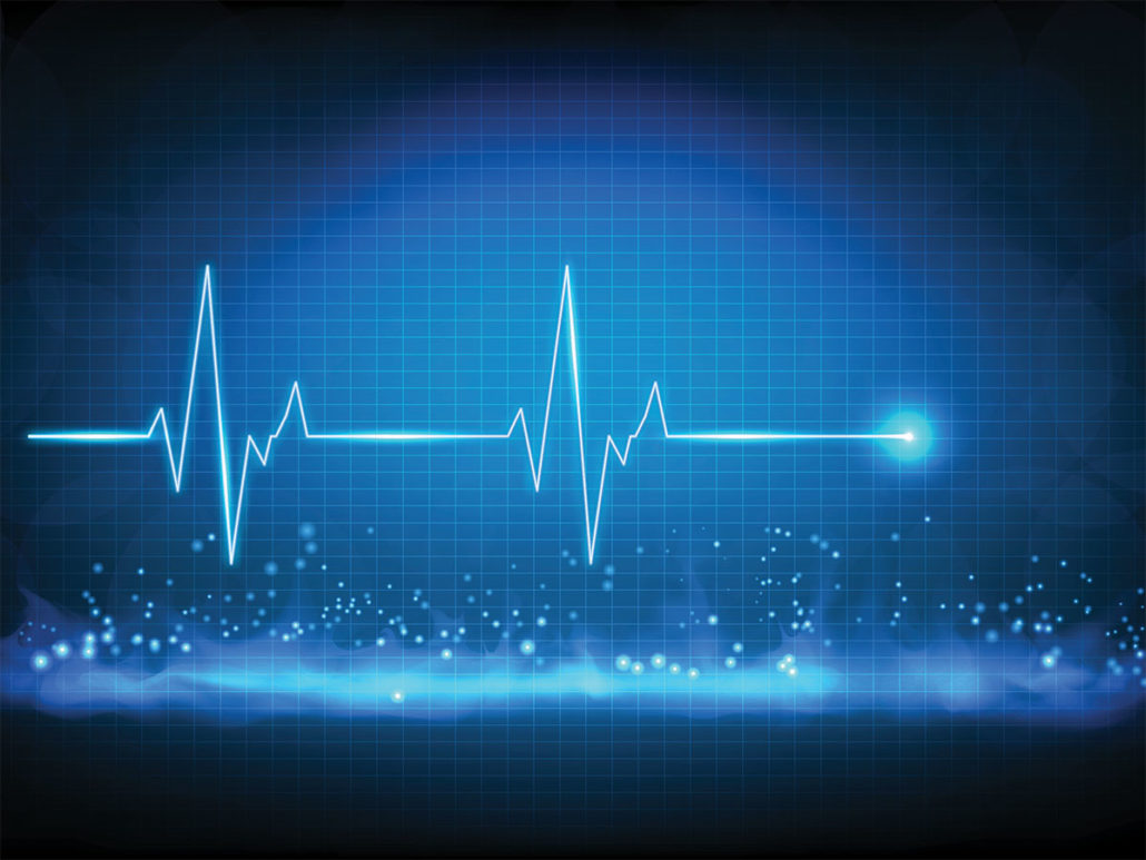 Pulse Monitored